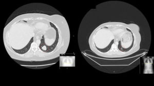 SALUD CANCER TRIAL DIAGNOSTICO