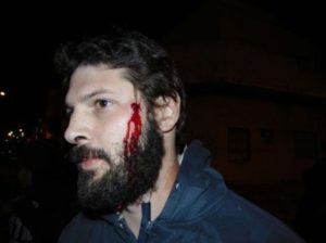Obrero-impactado-por-una-bala-de-goma-en-la-cabeza